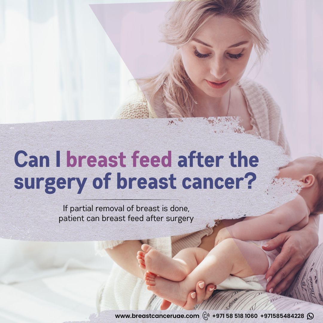 Can I breast feed after the surgery of breast cancer?