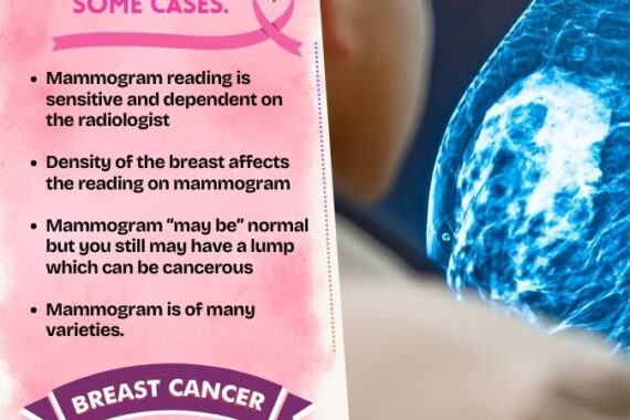 Mammogram can miss cancer in some cases