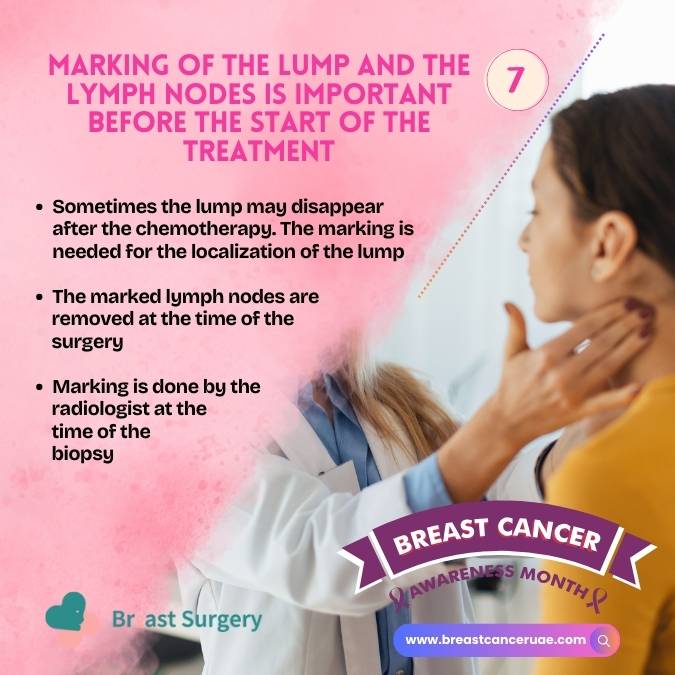 marking of the lump and the lymph nodes is important before the start of the treatment